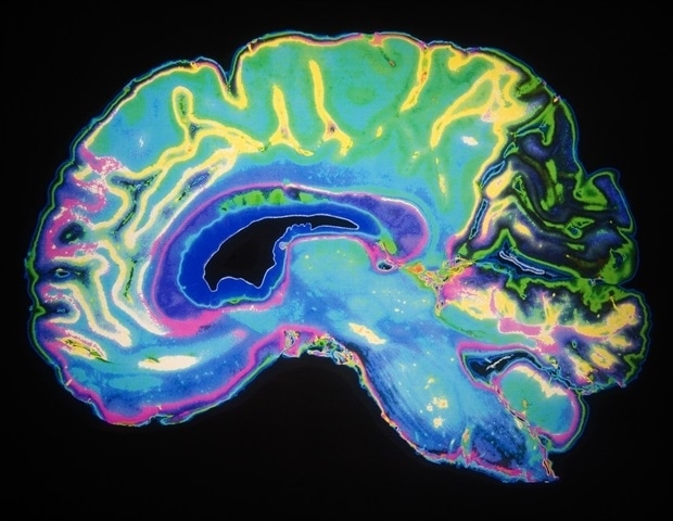 Desvantagem de vizinhança associada a diferenças na microestrutura do córtex cerebral